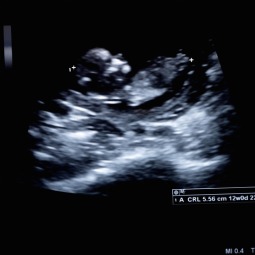 SEEING IS BELIEVING. A physician administers an ultrasound in a doctor's office in Montour Falls, N.Y. 
