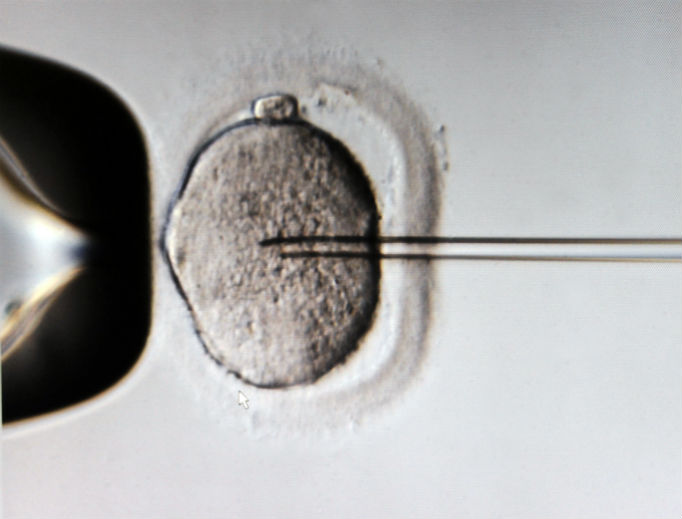 A monitor shows the microinjection of sperm into an egg cell using a microscope at the Kinderwunschzentrum in vitro fertilization clinic, in Leipzig, Germany.