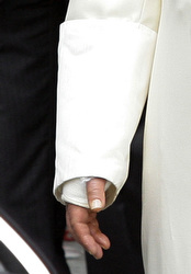 The Pope leaves the hospital with a cast on his right arm.
