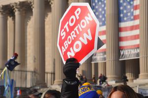 The Texas Heartbeat Act bans abortion after 6-weeks once a fetal heartbeat is recognized.