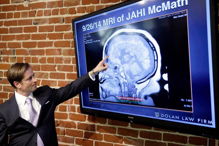 Attorney Christopher Dolan points to an MRI of Jahi McMath during an Oct. 3, 2014, news conference on the teen’s case, at his law office in San Francisco.