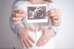 Proud parents show off their baby's ultrasound. Proud parents show off their baby's ultrasound.