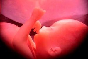 View of an unborn child in the womb
