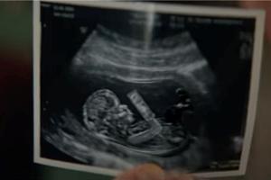 The ad, which aired during Super Bowl LVII on Feb. 12, 2023, featured a sonogram of an unborn baby.