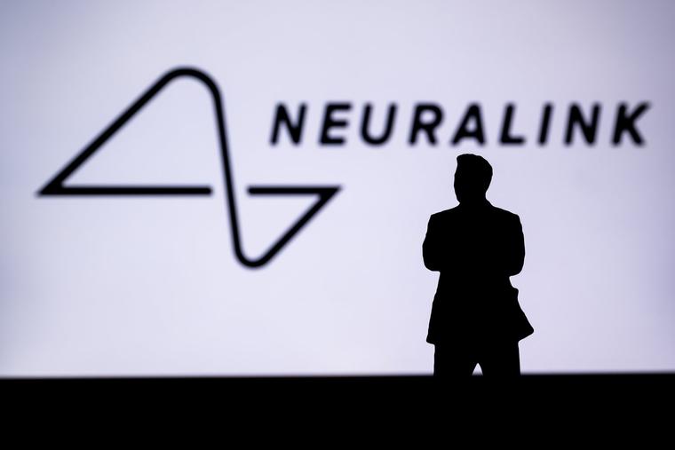 Neuralink's company logo features a silhouette of businessman Elon Musk, the company that first implanted a chip into the human brain.