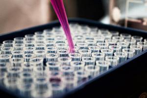 Church teaching opposes IVF because it separates the creation of life from the marital act between the husband and wife and results in the loss of unused embryos.