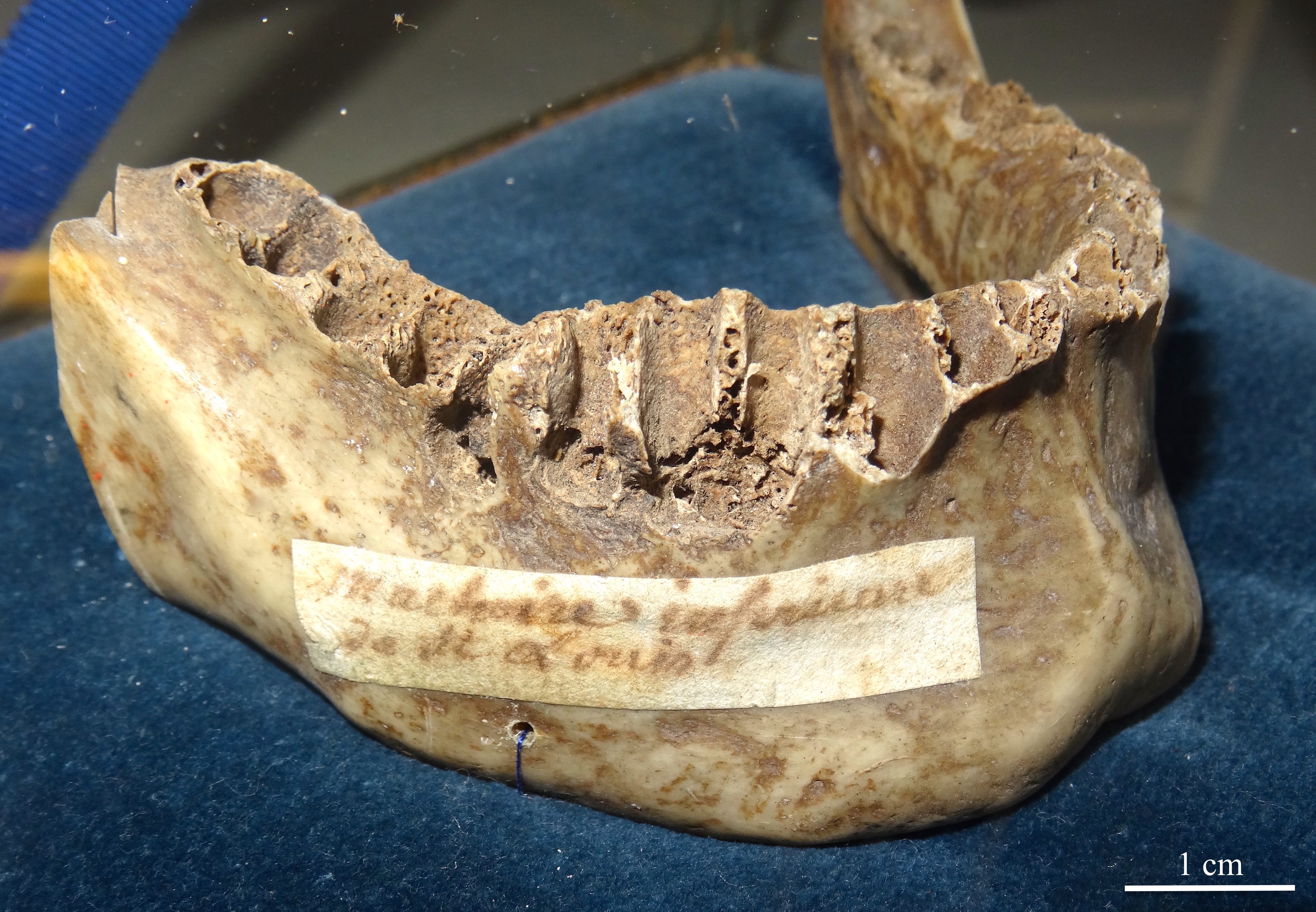 St. Louis’ jaw bone