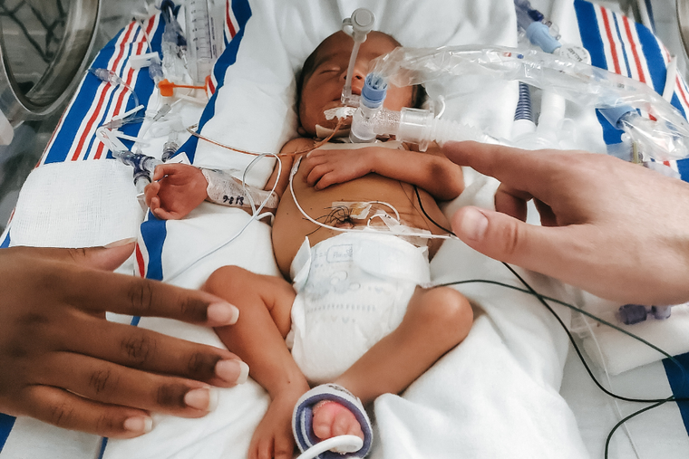 Meet the &lsquo;Miracle Baby&rsquo; Born Twice in Florida