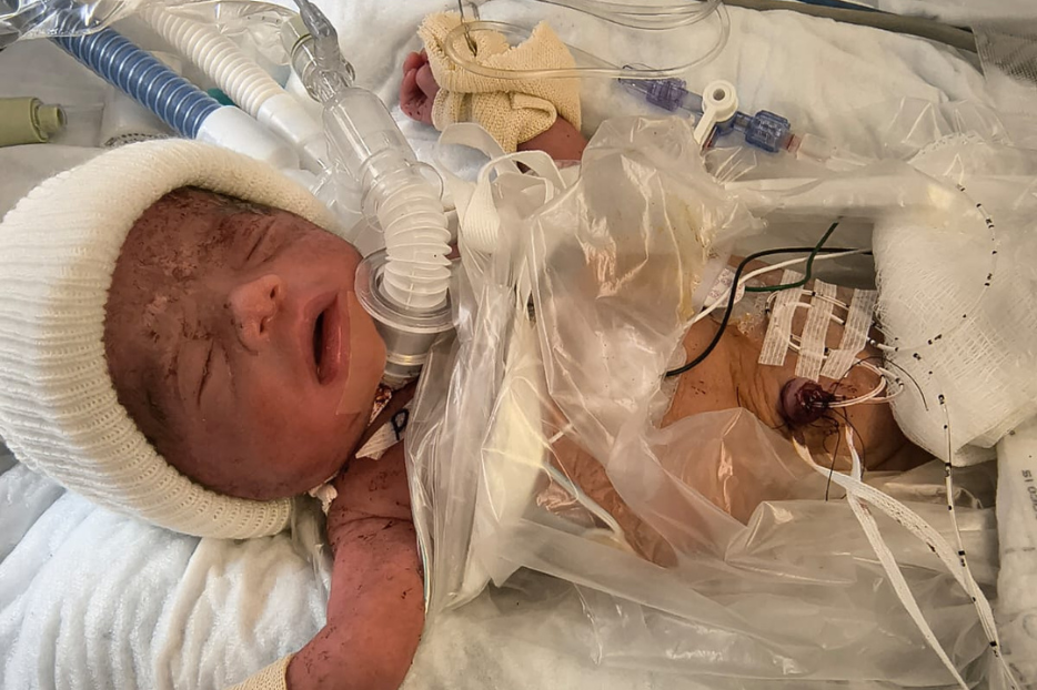 A young Cassian born twice in the hospital just after birth. 