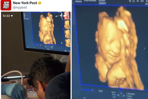 Lia Oliveira’s ultrasound visit has gone viral: Her unborn baby is seen smiling from the monitor at the sound of her father’s voice.